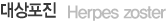 대상포진(Herpes zoster)